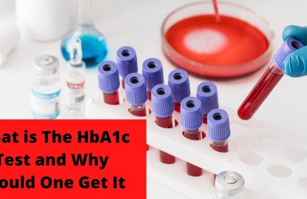 What is The HbA1c Test and Why Should One Get It
