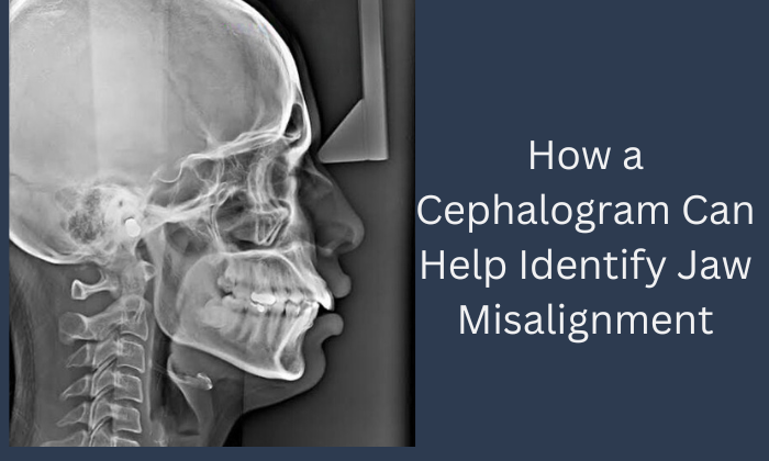 cephalogram misalignment