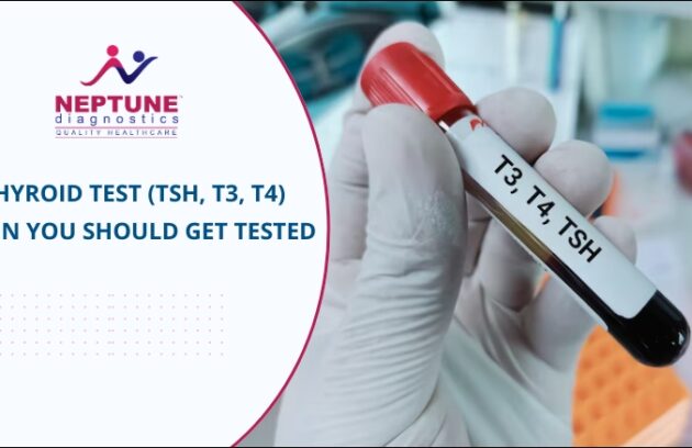 Thyroid Test (TSH, T3, T4): When You Should Get Tested