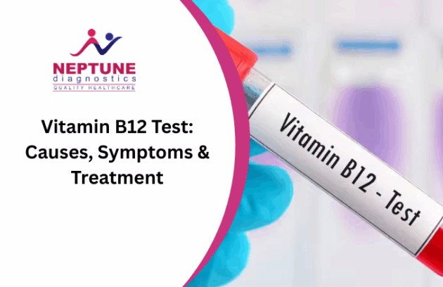 Vitamin B12 Test: Causes, Symptoms, Treatment & Diagnosis