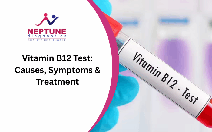 Vitamin B12 Test: Causes, Symptoms, Treatment & Diagnosis