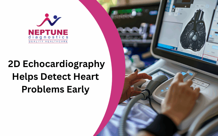 2D Echocardiography