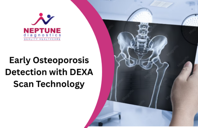 Early Osteoporosis Detection with DEXA Scan