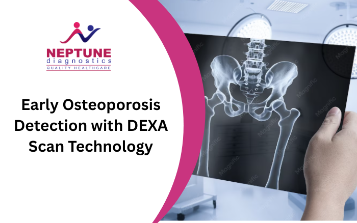 Early Osteoporosis Detection with DEXA Scan