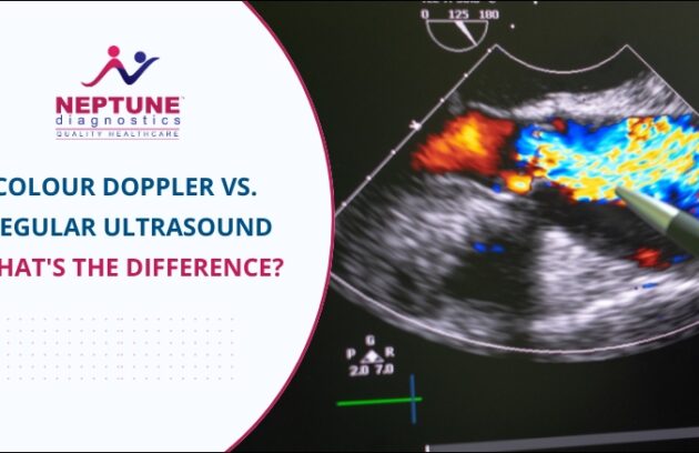 Colour Doppler vs. Regular Ultrasound: What's the Difference?