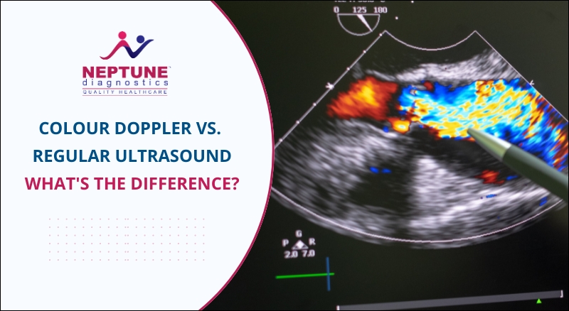 Colour Doppler vs. Regular Ultrasound: What's the Difference?