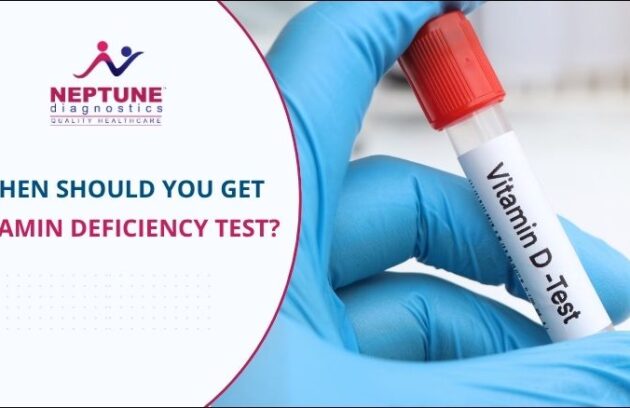 When Should You Get a Vitamin Deficiency Test?