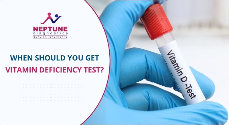 When Should You Get a Vitamin Deficiency Test?